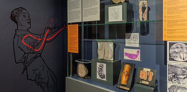 Ausstellung "Vorsicht Hochspannung" im Narrenturm in Wien
